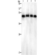 WB analysis of (1) Jurkat cells, (2) HeLa cells, (3) 231 cells, and (4) Mouse pancreas tissue, using KISS1R antibody (1/500 dilution) and Goat anti-Rabbit IgG secondary antibody (1/8000 dilution). Exposure time was 10 minutes, gel was 12% SDS-PAGE.