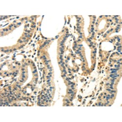 WNK Lysine Deficient Protein Kinase 2 (WNK2) Antibody