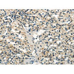 WNK Lysine Deficient Protein Kinase 2 (WNK2) Antibody