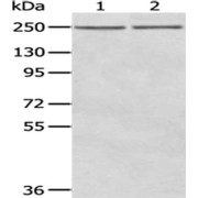 SDS-PAGE analysis of A431 cells (1) and MCF7 cells (2) using WNK2 antibody (1/200 dilution) and Goat anti-Rabbit IgG secondary antibody (1/8000 dilution).