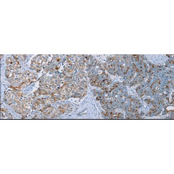 Mucin 1 (MUC1) Antibody