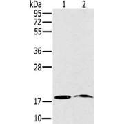 WB analysis of (1) Mouse Heart Tissue, and (2) Mouse Brain Tissue, using NDUFA3 Antibody (1/200 dilution). Exposure time: 400 seconds.