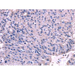 Tripartite Motif-Containing 14 (TRIM14) Antibody