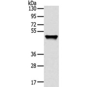 WB analysis (8% SDS-PAGE, 40 µg lysate) of human fetal liver tissue, using TRM14 antibody (1/800 dilution) and goat anti-rabbit IgG secondary antibody (1/8000 dilution). Exposure time: 1 min.