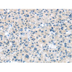 CD63 Antigen (CD63) Antibody