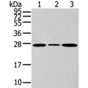 WB analysis of (1) NIH/3T3 cells, (2) K562 cells, and (3) 293T cells subjected to 12% SDS-PAGE, using CD63 Antibody (1/200 dilution).