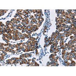 Histidine Triad Nucleotide Binding Protein 2 (HINT2) Antibody