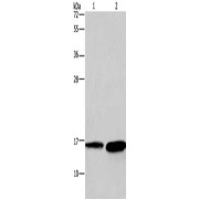 WB analysis of (1) mouse heart tissue, and (2) human hepatocellular carcinoma tissue, using HINT2 antibody (1/300 dilution).