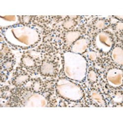 Tetraspanin 13 (TSPAN13) Antibody