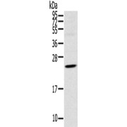 WB analysis of Human fetal brain tissue, using TSPAN13 antibody (1/550 dilution).