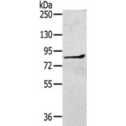 WB analysis of human bladder carcinoma tissue lysate (40 µg), using RASA2 Antibody (1/400 dilution).