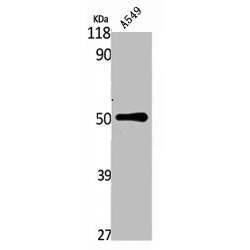 Tachykinin Receptor 3 (TACR3) Antibody