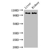 WB analysis of rat liver and mouse kidney tissue, using C6 antibody (2.7 µg/ml). Predicted band size: 105 kDa, observed band size: 105 kDa.