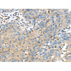 Insulin Like Growth Factor Binding Protein 4 (IGFBP4) Antibody