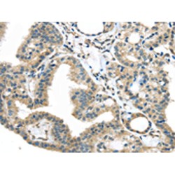 Insulin Like Growth Factor Binding Protein 4 (IGFBP4) Antibody