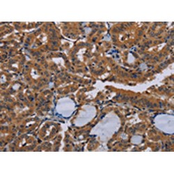 Neuronal Pentraxin I (NPTX1) Antibody