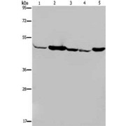 WB analysis of Human fetal muscle tissue (1), Jurkat cells (2), 293T cells (3), HeLa cells (4) and Mouse liver tissue (5), using IDH2 antibody (1/600 dilution).