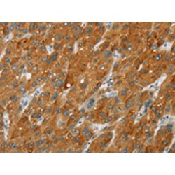 Cytochrome P450 2E1 (CYP2E1) Antibody