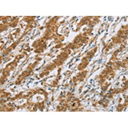 Cytochrome P450 2E1 (CYP2E1) Antibody