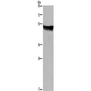 WB analysis of Mouse liver tissue, using CYP2E1 Antibody (1/250 dilution).