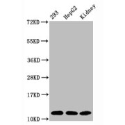 Western Blot<br/> Positive WB detected in: 293 whole cell lysate, HepG2 whole cell lysate, Mouse kidney tissue<br/> All lanes: Acetyl-Histone H4 (K16) antibody at 1.65 µg/ml<br/> Secondary<br/> Goat polyclonal to rabbit IgG at 1/50000 dilution<br/> Predicted band size: 11 KDa<br/> Observed band size: 11 KDa<br/>