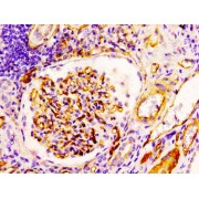 Immunohistochemistry analysis of CD34 Antibody diluted at 1:100 and staining in paraffin-embedded human kidney tissue. After dewaxing and hydration, antigen retrieval was mediated by high pressure in a citrate buffer (pH 6.0). Section was blocked with 10% normal goat serum 30min at RT. Then primary antibody (1% BSA) was incubated at 4°C overnight. The primary is detected by a biotinylated secondary antibody and visualized using an HRP conjugated SP system.