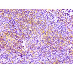 T-Cell Surface Glycoprotein CD4 (CD4) Antibody