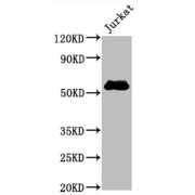 Western Blot<br/> Positive WB detected in: Jurkat whole cell lysate<br/> All lanes: CD4 antibody at 0.8 µg/ml<br/> Secondary<br/> Goat polyclonal to rabbit IgG at 1/50000 dilution<br/> Predicted band size: 55 KDa<br/> Observed band size: 55 KDa<br/>