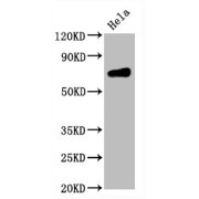 Western Blot<br/> Positive WB detected in: Hela whole cell lysate<br/> All lanes: CD86 antibody at 0.55 µg/ml<br/> Secondary<br/> Goat polyclonal to rabbit IgG at 1/50000 dilution<br/> Predicted band size: 70 KDa<br/> Observed band size: 70 KDa<br/>