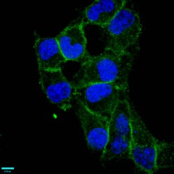 CD97 Antigen (ADGRE5) Antibody