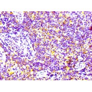 Immunohistochemistry analysis of CD97 Antibody diluted at 1/100 and staining in paraffin-embedded human lymph node tissue. After dewaxing and hydration, antigen retrieval was mediated by high pressure in a citrate buffer (pH 6.0). Section was blocked with 10% normal goat serum 30min at RT. Then primary antibody (1% BSA) was incubated at 4°C overnight. The primary is detected by a biotinylated secondary antibody and visualized using an HRP conjugated SP system.