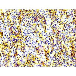 CD97 Antigen (ADGRE5) Antibody