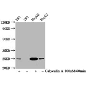 Western Blot<br/> Positive WB detected in: 293 whole cell lysate,HepG2 whole cell lysate (treated with Calyculin A or not)<br/> All lanes: Phospho-EIF4E antibody at 1.2 µg/ml<br/> Secondary<br/> Goat polyclonal to rabbit IgG at 1/50000 dilution<br/> Predicted band size: 25 KDa<br/> Observed band size: 25 KDa<br/>