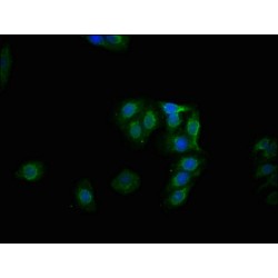 GYS1 (pS641) Antibody