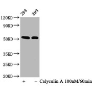 Western Blot<br/> Positive WB detected in: 293 whole cell lysate (treated with Calyculin A or not)<br/> All lanes: Phospho-TP53 antibody at 0.64 µg/ml<br/> Secondary<br/> Goat polyclonal to rabbit IgG at 1/50000 dilution<br/> Predicted band size: 53 KDa<br/> Observed band size: 53 KDa<br/>