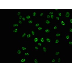 RPS6KB1 (pT421+pS424) Antibody