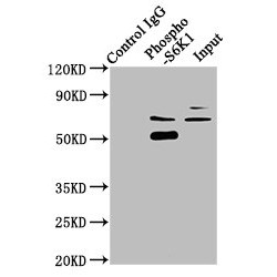 RPS6KB1 (pT421+pS424) Antibody