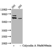 Western Blot<br/> Positive WB detected in: 293 whole cell lysate (treated with Calyculin A or not)<br/> All lanes: Phospho-RPS6KB1 antibody at 0.93 µg/ml<br/> Secondary<br/> Goat polyclonal to rabbit IgG at 1/50000 dilution<br/> Predicted band size: 70 KDa<br/> Observed band size: 70 KDa<br/>