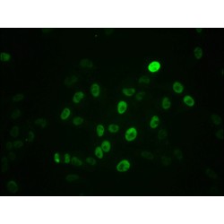 MYC (pS62) Antibody