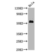 Western Blot<br/> Positive WB detected in: Hela whole cell lysate<br/> All lanes: Phospho-MYC antibody at 1.4 µg/ml<br/> Secondary<br/> Goat polyclonal to rabbit IgG at 1/50000 dilution<br/> Predicted band size: 57 KDa<br/> Observed band size: 57 KDa<br/>