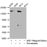 Western Blot<br/> Positive WB detected in: A549 whole cell lysate,Hela whole cell lysate(treated with Pervanadate or EGF)<br/> All lanes: Phospho-EGFR antibody at 1.35 µg/ml<br/> Secondary<br/> Goat polyclonal to rabbit IgG at 1/50000 dilution<br/> Predicted band size: 170 KDa<br/> Observed band size: 170 KDa<br/>