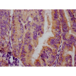 FOXO3 (pS253) Antibody