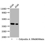 Western Blot<br/> Positive WB detected in: A549 whole cell lysate(treated with Calyculin A or not)<br/> All lanes: Phospho-NFKBIA antibody at 1.07 µg/ml<br/> Secondary<br/> Goat polyclonal to rabbit IgG at 1/50000 dilution<br/> Predicted band size: 39 KDa<br/> Observed band size: 39 KDa<br/>