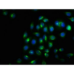 ERN1 (pS724) Antibody