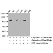 Western Blot<br/> Positive WB detected in: 293 whole cell lysate, A549 whole cell lysate, Hela whole cell lysate (treated with Calyculin A or EGF)<br/> All lanes: Phospho-ERN1 antibody at 0.75 µg/ml<br/> Secondary<br/> Goat polyclonal to rabbit IgG at 1/50000 dilution<br/> Predicted band size: 110 KDa<br/> Observed band size: 110 KDa<br/>