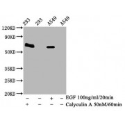 Western Blot<br/> Positive WB detected in: 293 whole cell lysate, A549 whole cell lysate (treated with Calyculin A or EGF)<br/> All lanes: Phospho-PRKAA2 antibody at 1.95 µg/ml<br/> Secondary<br/> Goat polyclonal to rabbit IgG at 1/50000 dilution<br/> Predicted band size: 62 KDa<br/> Observed band size: 62 KDa<br/>