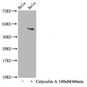 Western Blot<br/> Positive WB detected in: Hela whole cell lysate(treated with Calyculin A or not)<br/> All lanes: Phospho-MAPT antibody at 1.63 µg/ml<br/> Secondary<br/> Goat polyclonal to rabbit IgG at 1/50000 dilution<br/> Predicted band size: 46 KDa<br/> Observed band size: 46 KDa<br/>