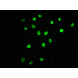 ATF2 (pT71) Antibody