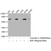 Western Blot<br/> Positive WB detected in: 293 whole cell lysate, A549 whole cell lysate,HepG2 whole cell lysate(treated with Calyculin A or EGF)<br/> All lanes: Phospho-ATF2 antibody at 1.015 µg/ml<br/> Secondary<br/> Goat polyclonal to rabbit IgG at 1/50000 dilution<br/> Predicted band size: 70 KDa<br/> Observed band size: 70 KDa<br/>