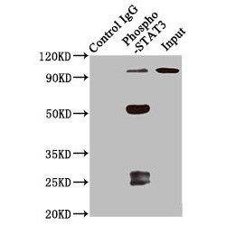 Signal Transducer and Activator of Transcription 3 Phospho-Ser727 (STAT3 pS727) Antibody